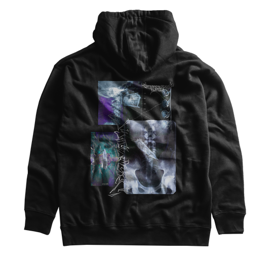 X-ray Hoodie